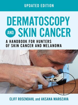 cover image of Dermatoscopy and Skin Cancer, updated edition